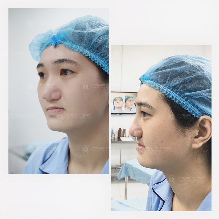 Hình ảnh trước và sau khi bác sĩ trung thực hiện ca phẫu thuật