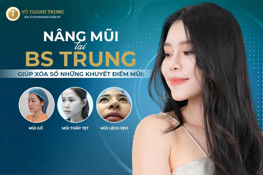 đối tượng phù hợp nâng mũi