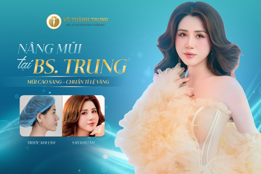 Nâng mũi tại BS. Trung - Mũi cao sang, chuẩn tỉ lệ vàng Nâng mũi tại BS. Trung - Mũi cao sang, chuẩn tỉ lệ vàng