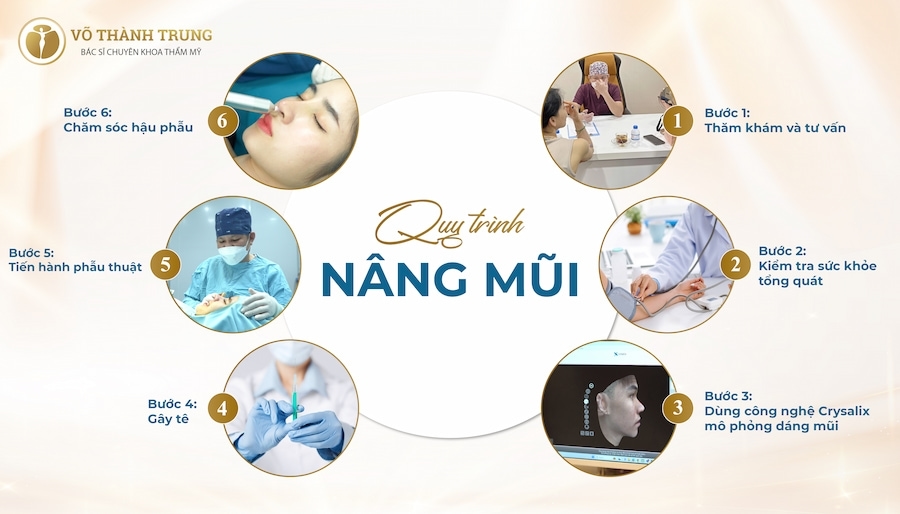 Quy trình nâng mũi chuẩn y khoa tại bs Trung