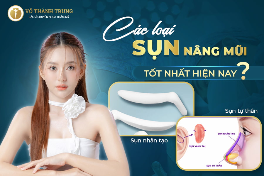 Tổng hợp các loại sụn nâng mũi tốt nhất hiện nay