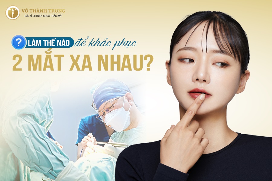 Làm thế nào để khắc phục 2 mắt xa nhau? Làm thế nào để khắc phục 2 mắt xa nhau?
