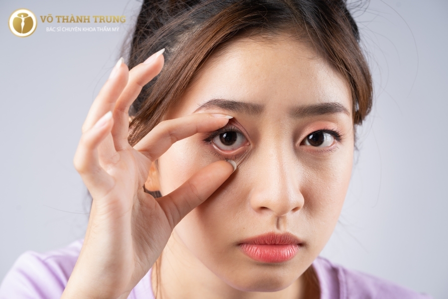 Hai mắt xa nhau trong nhân tướng học hội tụ cả những ưu và khuyết điểm Hai mắt xa nhau trong nhân tướng học hội tụ cả những ưu và khuyết điểm