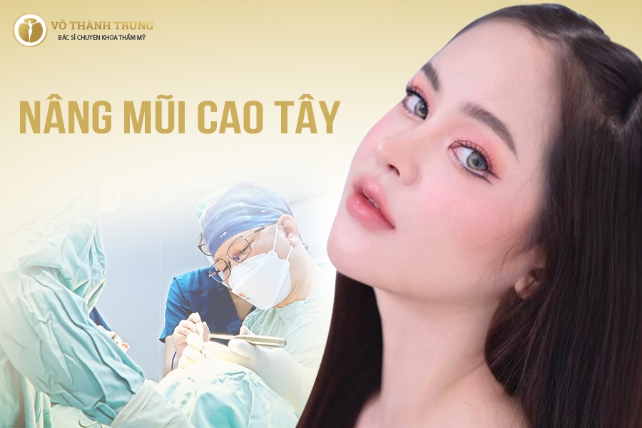 Nâng mũi cao tây là như thế nào? Có nên nâng mũi Tây không? Nâng mũi cao tây là như thế nào? Có nên nâng mũi Tây không?