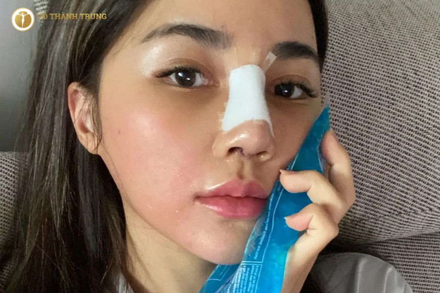 Việc nâng mũi cao Tây có thể gặp một số rủi ro nếu thực hiện bởi bác sĩ thiếu kinh nghiệm Việc nâng mũi cao Tây có thể gặp một số rủi ro nếu thực hiện bởi bác sĩ thiếu kinh nghiệm