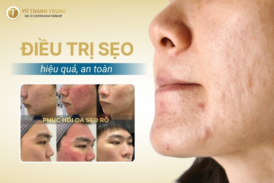 Sẹo và các phương pháp điều trị sẹo hiệu quả tại BS. Trung Sẹo và các phương pháp điều trị sẹo hiệu quả tại BS. Trung