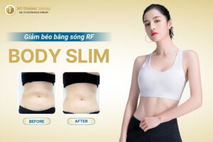 Giảm béo bằng sóng RF - Đánh tan mỡ thừa, kiến tạo đường cong
