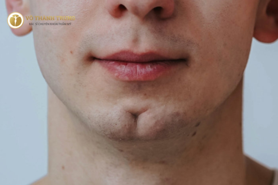 Cằm chẻ nam có sự nghiệp bền vững, hậu vận sung túc
