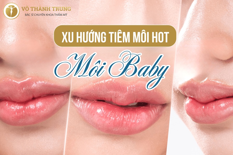 Xu hướng tiêm dáng môi baby lip đẹp tự nhiên, tròn đầy
